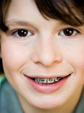 牙齿畸形危害之儿童脸部发育不均匀--广州德伦