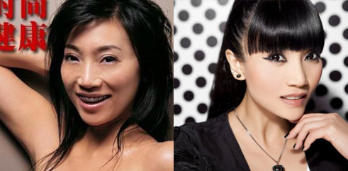 儿童龋齿_儿童正畸_儿童牙外伤_窝沟封闭_广