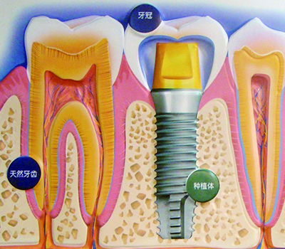 牙科医生猜成语_牙科医生(3)