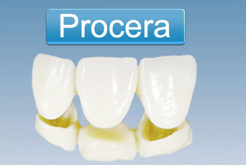 瑞典计算机氧化锆牙齿美容修复是什么