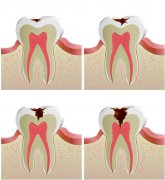 ��ҹ����˯���ţ�5��֢״�ж������ף����������������ô��