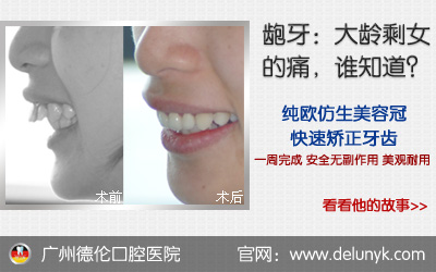 广州做暴牙矫正需要多少钱