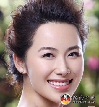 烤瓷牙修复失败后怎么办--广州德伦口腔