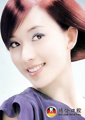 隐形矫牙怎么样--广州德伦口腔