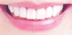 ǸSPA