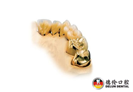 钴铬合金烤瓷牙有什么优点