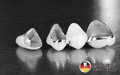 镍铬合金烤瓷牙安全吗--广州德伦口腔