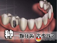 ֲһŶǮ
