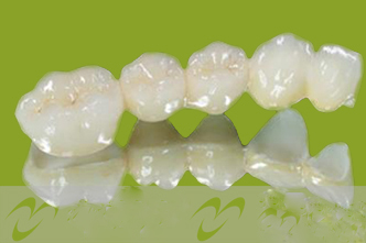 全瓷牙日常护理需知--广州德伦口腔