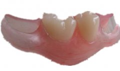 ʹöã