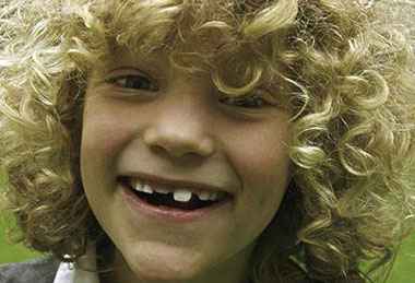 缺失牙的危害--广州德伦口腔医院