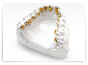 舌侧隐形矫正技术--广州德伦口腔