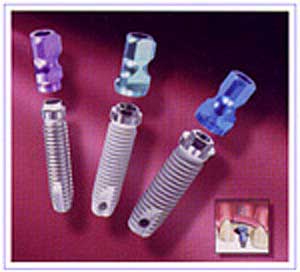 如何选择种植牙材料?