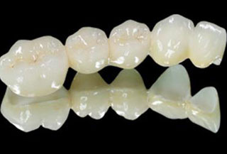 什么是德国vita牙齿美容修复?