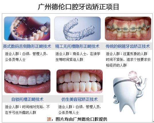 牙齿矫正的方法有哪些?牙齿矫正5大技术优点