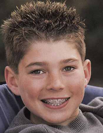 儿童牙齿矫正的最佳年龄--广州德伦口腔