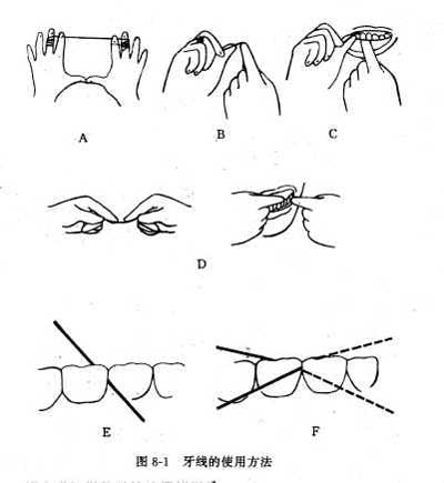 使用牙线有什么好处?如何正确使用牙线?--广州德伦口腔