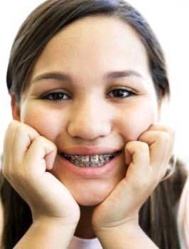 使用牙齿矫正器要注意什么--广州德伦口腔