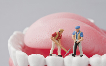 最好的牙齿美白方法是什么--广州德伦口腔