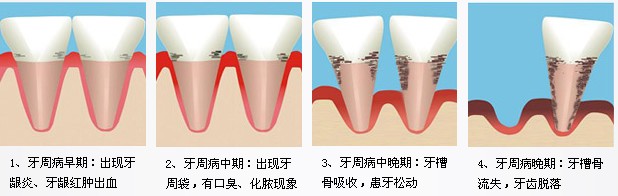 老人口中出血_手出血图片