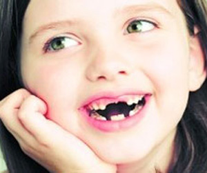 孩子6岁开始换牙了,需要注意什么?