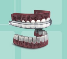 3D全瓷牙贴面快速永久美白--广州德伦口腔