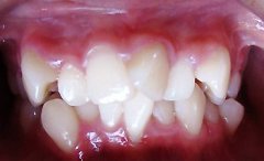 ݲΣ ݽ׼ȷ