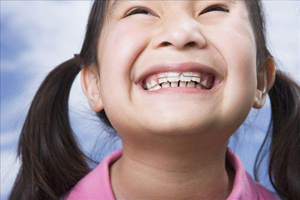 儿童牙齿矫正多少钱?