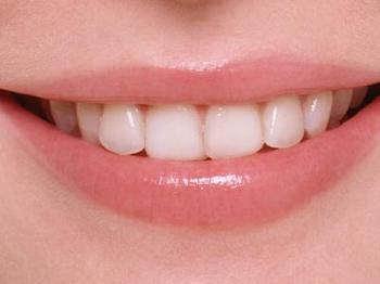 各种牙齿矫正方法价格是多少?_广州德伦口腔