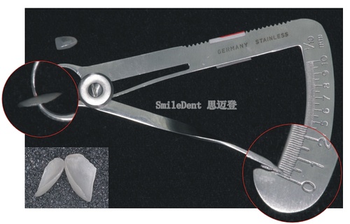 3D全瓷牙贴面厚度薄至0.2mm_广州德伦口腔
