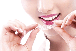 牙齿矫正的好方法_广州德伦口腔