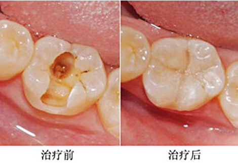 家门口就能看牙了！上海推动社区标准化口腔诊室建设