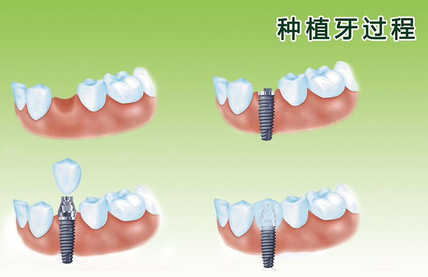105-1411121H40S94.jpg