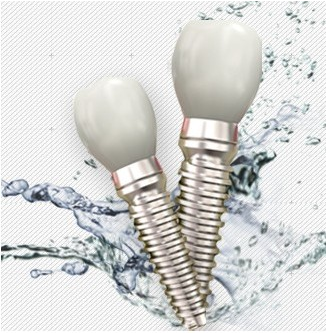 种植牙寿命可以比天然牙还长--广州德伦口腔