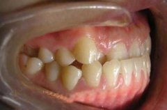 ݵذĿݵķ