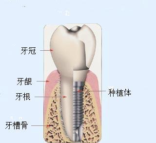 哪些东西对牙齿有好处 105-15042514192Y34.jpg