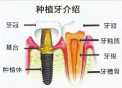 ֲ޸ȱʧ