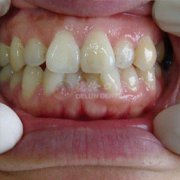 ݽҪǮ