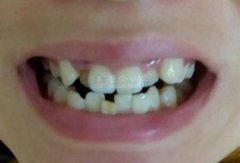 ݲЩΣ