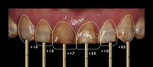 专访崔巧明:牙齿形态与容貌一样重要_广州德伦