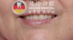 71ʱ̫ 40ݴ