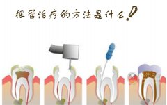 رʹô