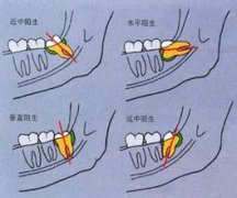 ǳʱʹô?