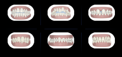 ݲĵĲӰ