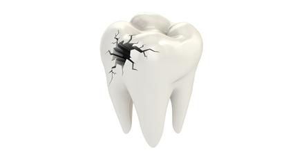 广州儿童牙齿缺损怎么办_广州德伦口腔