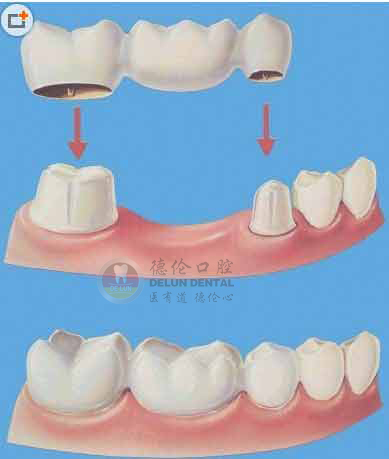 һݹҪǮ
