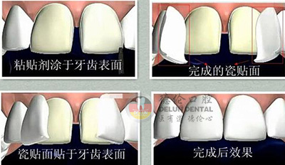 3DҪǮ