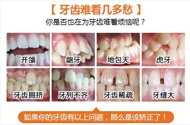 整牙堪比换脸!矫牙对脸型的影响有多大_广州德