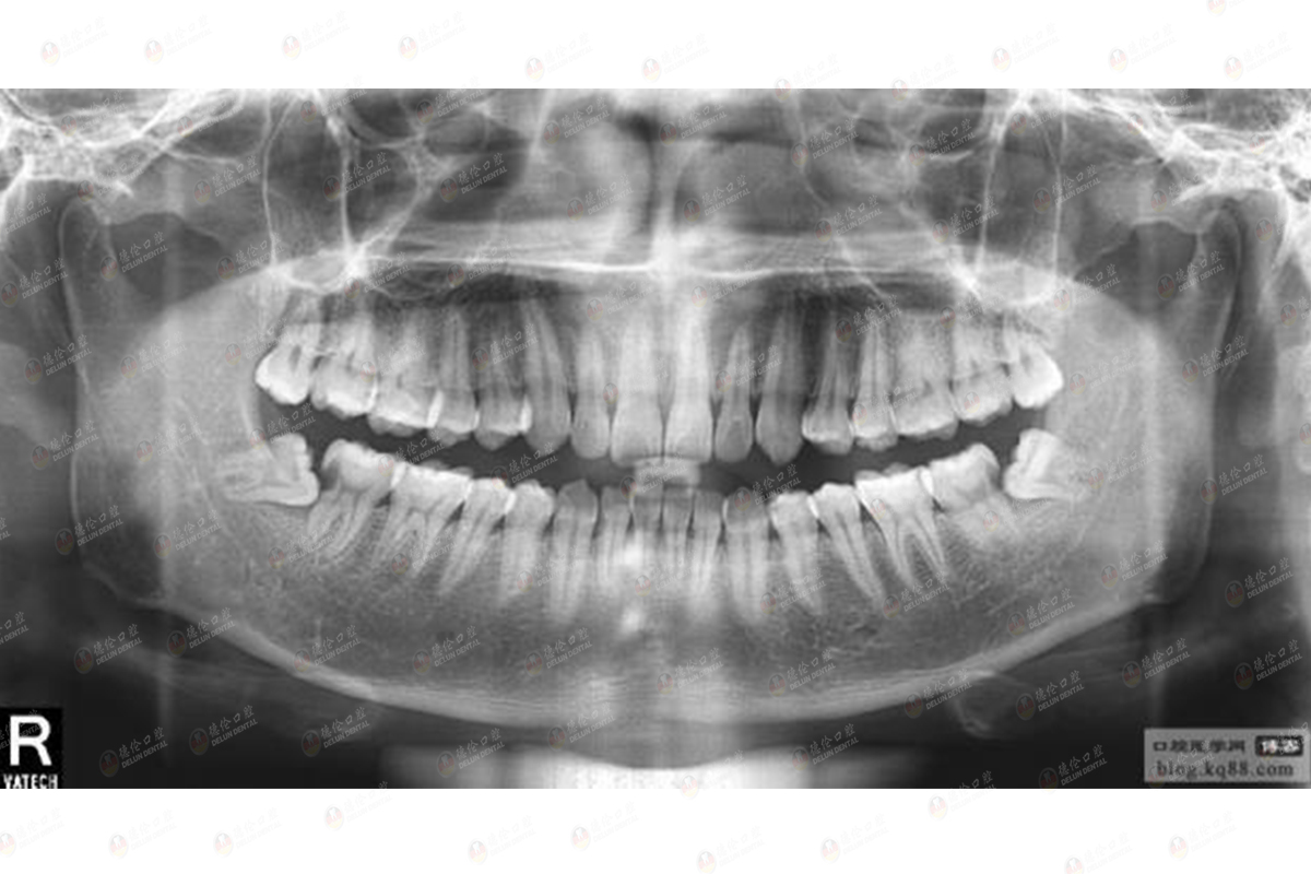看过来!6大口腔保健误区!_广州德伦口腔