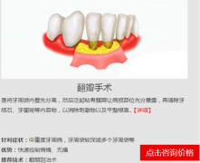 пǻҽԺ